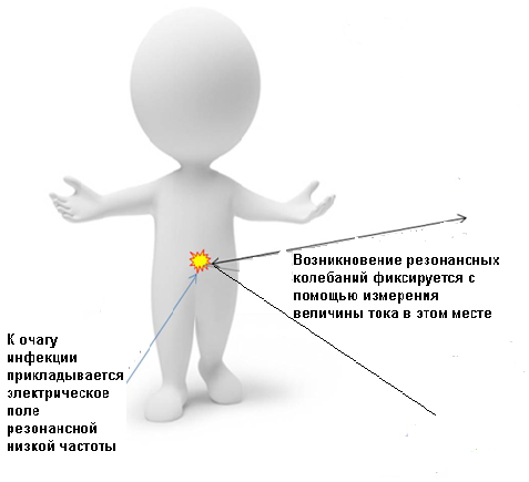 Рис. 5. Схема коррекции патологий внутри организма бесконактными электрическим воздействиями 